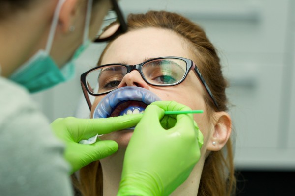 Nanášení ochranné dásňové bariéry