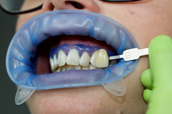 Porovnání výchozího odstínu